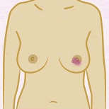 Diagram showing redness